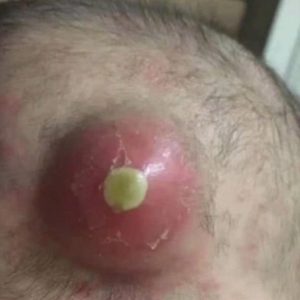 8 Skin Signals Your Body Is Begging You to Take Notice—Before It’s Too Late