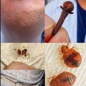 He Thought It Was Just an Itch—Until His Body Started Falling Apart