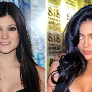 Kylie Jenner’s New Face? Fans Claim Shocking Transformation After Latest Photos