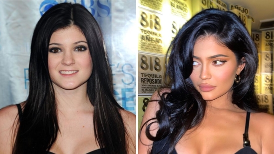 Kylie Jenner’s New Face? Fans Claim Shocking Transformation After Latest Photos